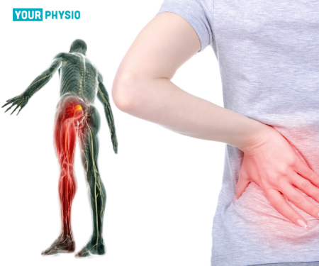 Sciatica: Special Physiotherapy Tests, Diagnosis & Treatment